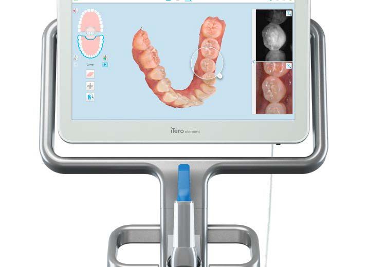 iTero Element Intraoral Scanner D & S Dental Laboratory, Inc.